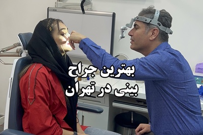 ویژگی‌های بهترین جراح بینی در تهران از نگاه بیماران