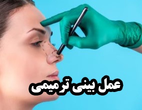 عمل ترمیم بینی بعد از جراحی ناموفق ؛ راهکارهای تخصصی