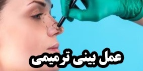 عمل ترمیم بینی بعد از جراحی ناموفق ؛ راهکارهای تخصصی