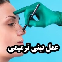 عمل ترمیم بینی بعد از جراحی ناموفق ؛ راهکارهای تخصصی