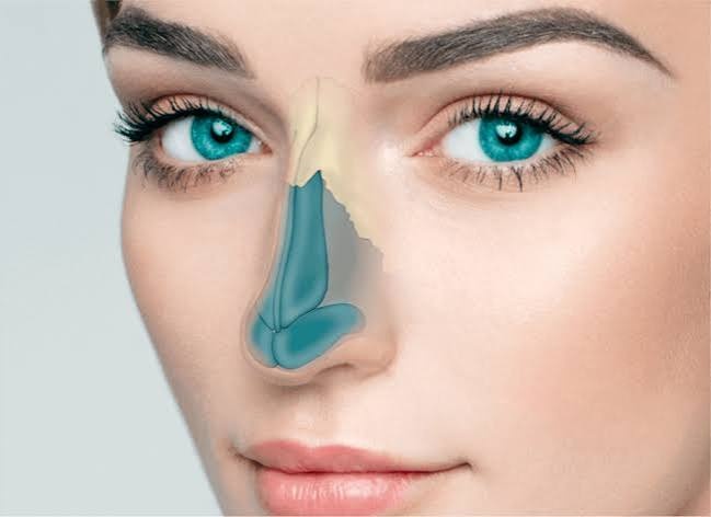 عمل بزرگ کردن بینی