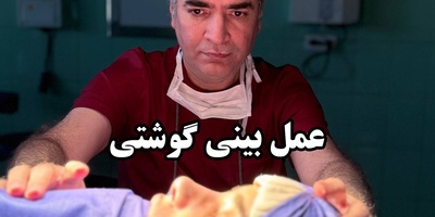 آیا عمل بینی گوشتی نتیجه دائمی دارد؟