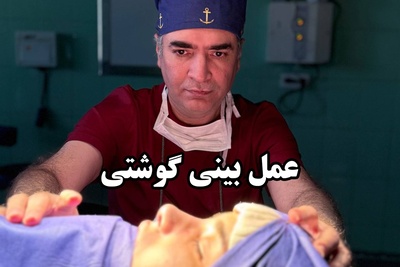 آیا عمل بینی گوشتی نتیجه دائمی دارد؟