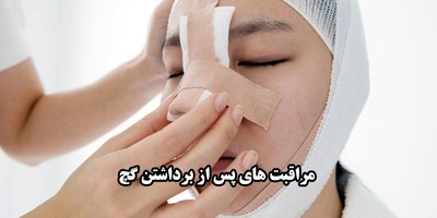 مراقبت از بینی بعد از برداشتن گچ
