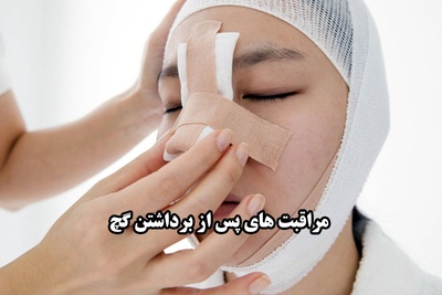 مراقبت از بینی بعد از برداشتن گچ