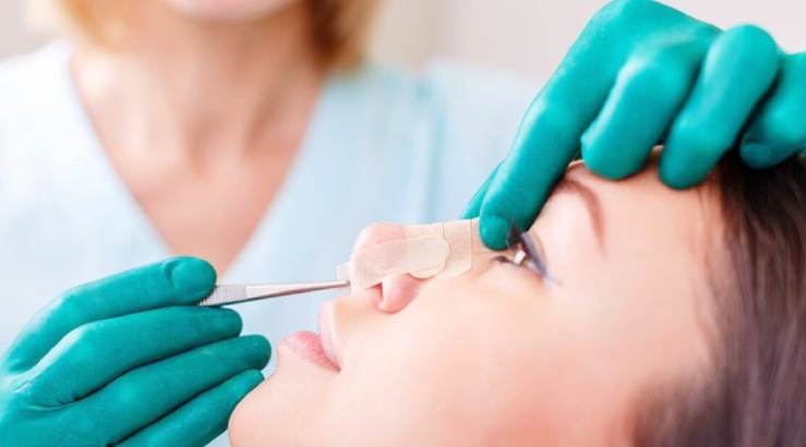 رینوپلاستی