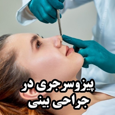 پیزوسرجری در جراحی بینی؛ تکنولوژی نوین بدون آسیب به بافت