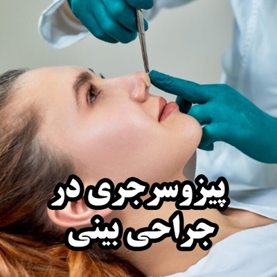 پیزوسرجری در جراحی بینی؛ تکنولوژی نوین بدون آسیب به بافت