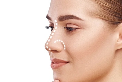 عمل بینی غضروفی چیست؟ +راهنمای کامل جراحی بینی غضروفی
