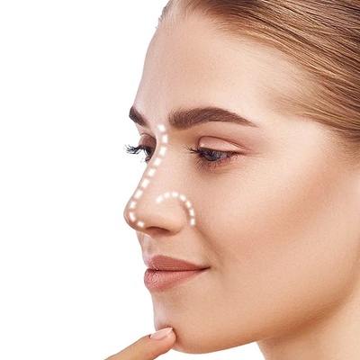 عمل بینی غضروفی چیست؟ +راهنمای کامل جراحی بینی غضروفی