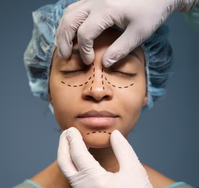 چالشهای عمل بینی گوشتی