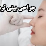 جراحی بینی ترمیمی برای اصلاح نتایج قبلی