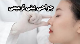 جراحی بینی ترمیمی برای اصلاح نتایج قبلی