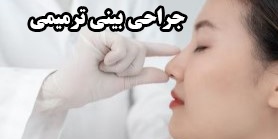 جراحی بینی ترمیمی برای اصلاح نتایج قبلی