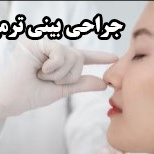 جراحی بینی ترمیمی برای اصلاح نتایج قبلی